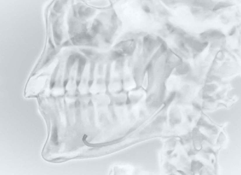 dentysta radiologia bielsko