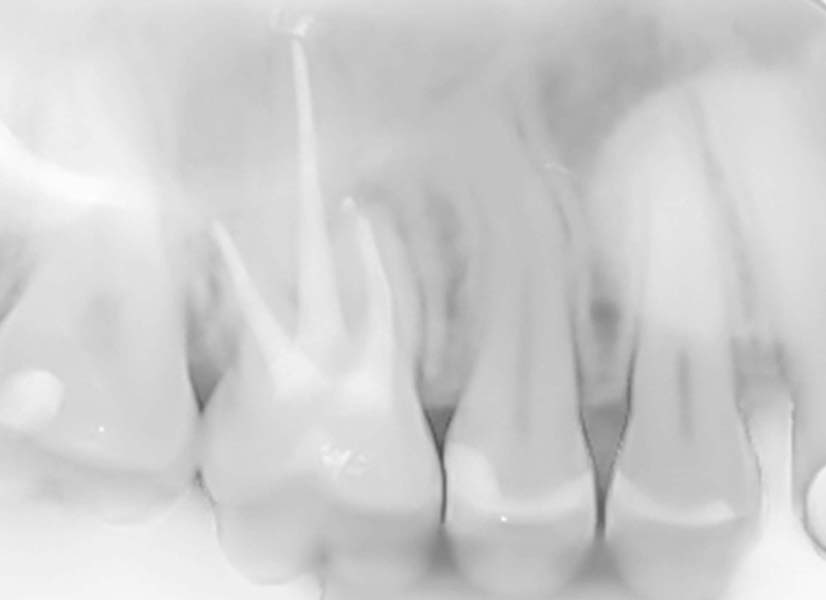 stomatologia endodoncja bielsko