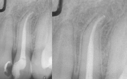 implantologia dentysta bielsko